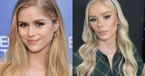 Erin Moriarty’s transformation post-plastic surgery