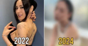 Nana Is Seemingly Almost Finished With Her Tattoo Removal — Netizens Are Heavily Divided At The Results