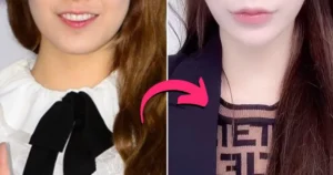 Idol-Actress Returns With Changed Visuals After Drunk-Driving Scandal