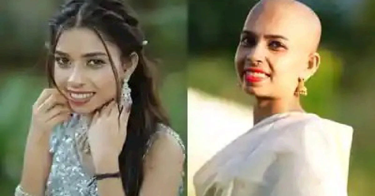 Bigg Boss Malayalam 7 Contestant Renu Sudhi in ICU After 5 Rounds of Chemotherapy; Friend Sarika KB Shares Health Update